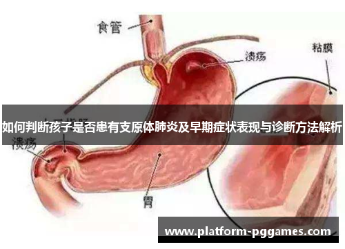 如何判断孩子是否患有支原体肺炎及早期症状表现与诊断方法解析